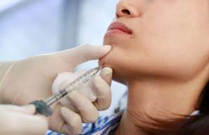 chin augmentation